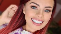 Composite Veneers - Cosmetic Dentistry - Kristina Lauren - 3Dental